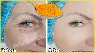 Even if you are 70, 🌹 apply it to wrinkles, it will make your face taut like glass / Stronger botox