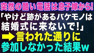 【スカッとする話】突然の酷い電話は、息子嫁からだった！「やけど跡があるバケモノは結婚式に来ないで！」→言われた通り参加しなかった結果....w【修羅場】