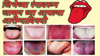 जिभेच्या रंगावरून होते आजारांची ओळख l Tongue tells about our health l जीभ का रंग बताता है बिमार