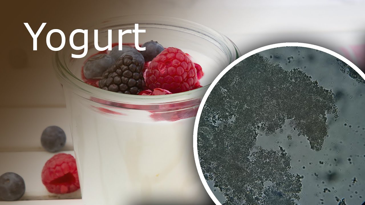 Yogurt Under Microscope At William Fellows Blog