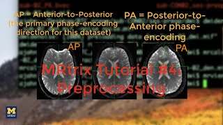 MRtrix Tutorial #4: Preprocessing