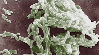 9 dead from deadly listeria outbreak | What  to know