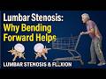 Why Bending Forward Relieves Spinal Stenosis (Shopping Cart Sign Explained)