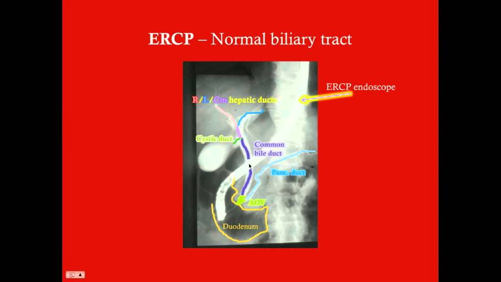 Biliary Tract - CRASH! Medical Review Series - YouTube