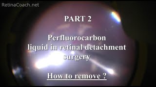 Part 2. Basics of perfluorocarbon liquid use: How to remove?