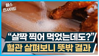 [헬스인사이드] “살짝 찍어 먹었는데도?” 혈관 살펴보니 뜻밖 결과 / 머니투데이방송