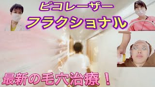 【ピコレーザーフラクショナル】スタッフさんが体験！照射のようすをご紹介！