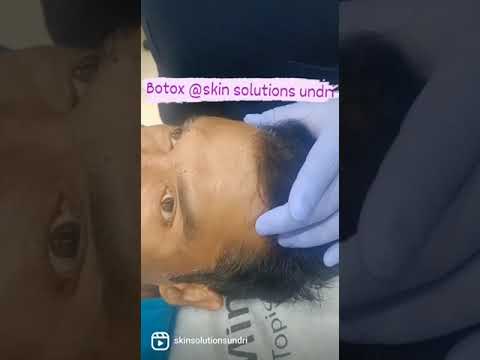 Botox Treatment | Skin Solution | Best Skin Clinic In Undri Pune - YouTube