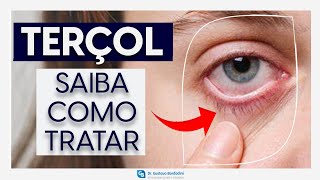 Hordéolo e Terçol: o que é, sintomas e tratamento - Dr. Gustavo Bonfadini