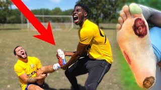 I Superglued Football Boots To My Feet.. BAD INJURY (24 Hour Challenge)