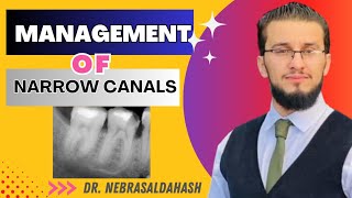 Narrow Canals Management || Dr. Nebras Aldahash