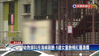 幼教師科技海綿刷臉 6歲女童臉頰紅腫潰爛－民視新聞