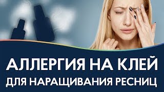 ТОП 10 средств от аллергии на клей для наращивания ресниц