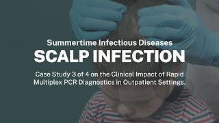 Case 3: Tinea | Summertime Infectious Disease Webinar