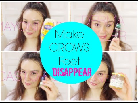 How to Get Rid of Crows-Feet How to Get Rid of Crows-Feet
