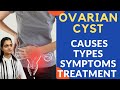 Ovarian Cyst क्या होती है | Ovary में गाँठ के कारण, लक्षण और इलाज in Hindi - Dr. Mayuri Kothiwala.