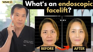 What's an Endoscopic Facelift?| Wave Plastic Surgery