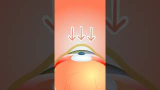 Can WELDING really make you BLIND? (3D Animation) #Shorts