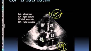 심장초음파, echo 500 해설강의 356~360