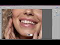 Ретушь зубов в photoshop. Создаем голливудскую улыбку. Изменение формы яркости и тона зубов