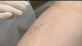 Tucson Living: Skin cancer risks