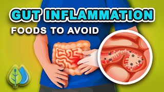 Top 5 Foods that Cause GUT Inflammation - AVOID  | eat these anti inflammatory foods