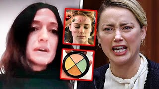 Amber Heard EXPOSED By Nurse For Using Make-Up to Fake Bruises