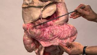 Anatomy Series, The Thoracic and Abdominal Viscera by Dr. Shakti Chandra