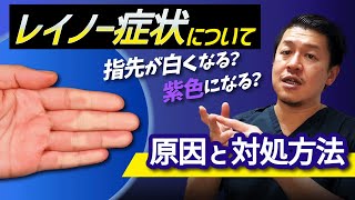 【血管外科医解説】レイノー症状について｜寒さで指先が白く？｜原因と対処方法