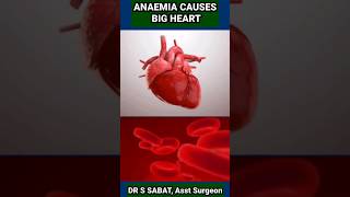 ANAEMIA CAUSES BIG HEART | #drssabat #trending #viral