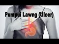 PUMPUI LAWNG (Peptic Ulcer)