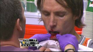 Steve Nash Bloody Lip, Elbowed by Earl Watson