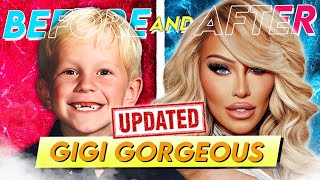 Gigi Gorgeous | Before & After | Her  Transformation | UPDATE