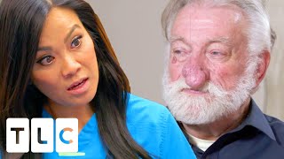 "This Was Meant To Be": Dr Lee Removes Her Limousine Driver's Rhinophyma | Dr. Pimple Popper