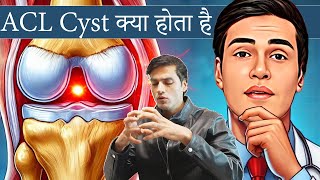 ACL Cyst क्या होता है ?