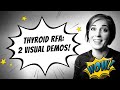 Thyroid RFA: Two visual demos