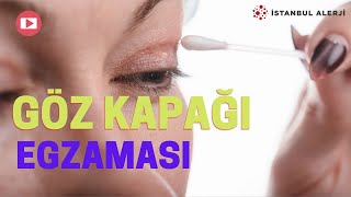 Göz Kapağı Egzaması  - İstanbul Alerji - Prof. Dr. Ahmet Akçay