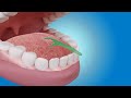 bfresh flossers 3 in 1 usage video to avoid bad breath to maintain healthy gums and fresh feeling