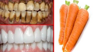 how to get white teeth at home teeth whiting  with carrot natural ayurvedic