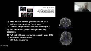 QSIPrep – Preprocessing pipeline for Diffusion MRI
