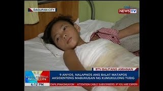 BP: 9-anyos, nalapnos ang balat matapos aksidenteng mabuhusan ng kumukulong tubig