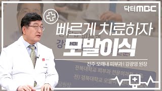 탈모는 빠르게 대처하는 게 좋습니다! 부담감 없이 치료해 보시죠🏥 | 건강지킴이 닥터MBC | 의학상식 | 모발이식 | 전주MBC 220522 방송