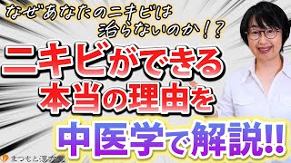 ニキビの本当の原因と治し方を、中医学のプロが解説します！！