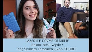 Tüm Aşamaları İle Dövmemi Nasıl Sildiriyorum? | SOHBET.