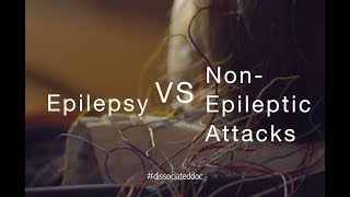 Epilepsy VS Non-Epileptic Attacks | Misdiagnosis & Key Differences