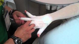 Arm Lymphedema wrapping