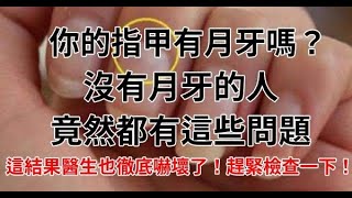 太恐怖！指甲上沒有「月牙」的人，他們竟然都有這些問題！這結果醫生也徹底嚇壞了！趕緊檢查一下