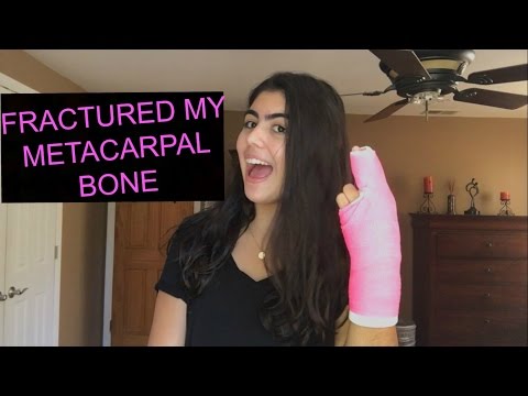 I FRACTURED MY METACARPAL BONE? STORY TIME WITH GABBY I FRACTURED MY METACARPAL BONE? STORY TIME WITH GABBY