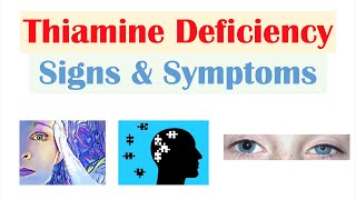 Thiamine (Vit B1) Deficiency Signs \u0026 Symptoms (\u0026 Why They Occur)