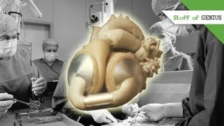 Robert Jarvik and the Artificial Heart